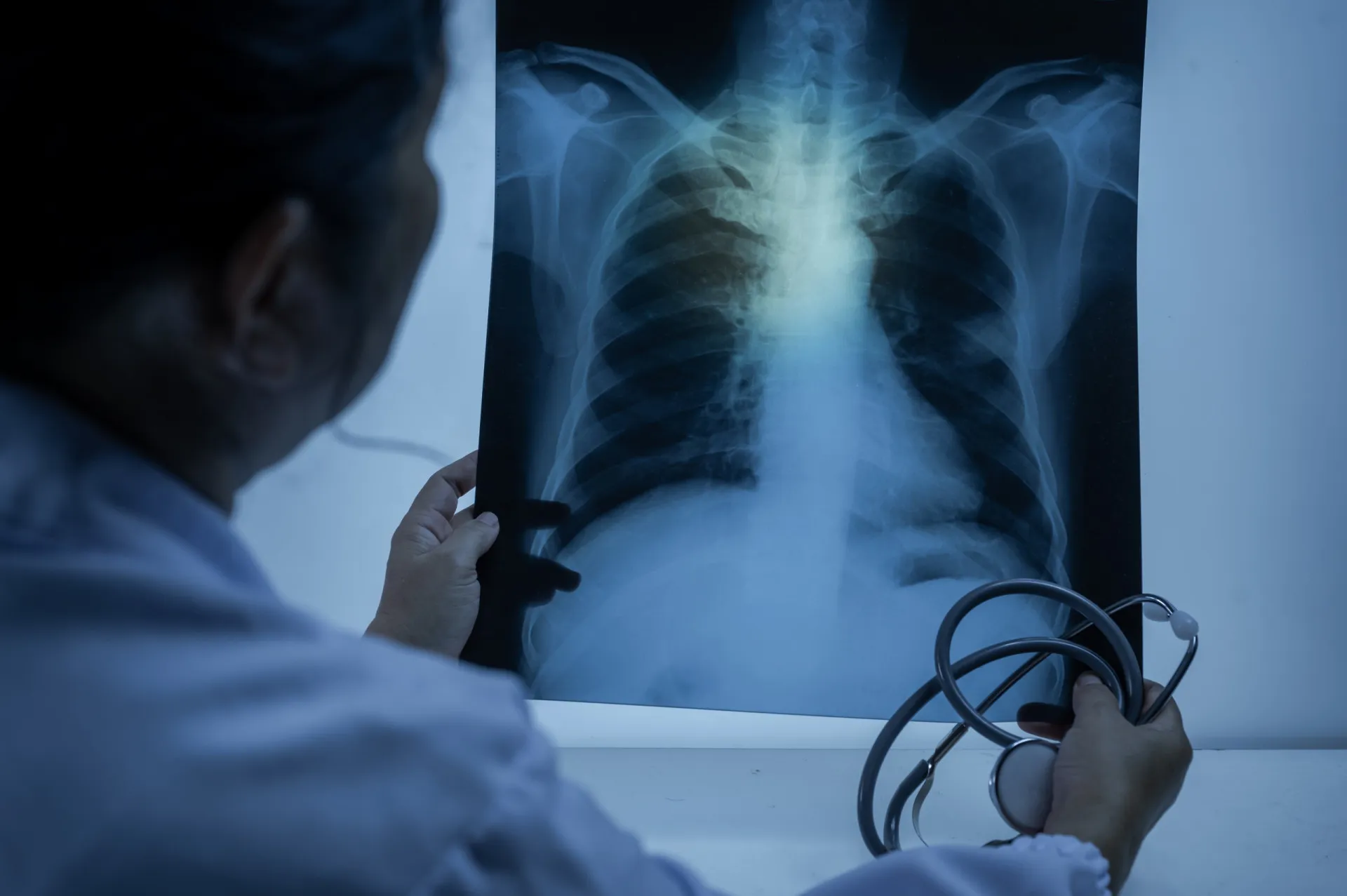 Pneumonia e seus graves riscos para a saúde